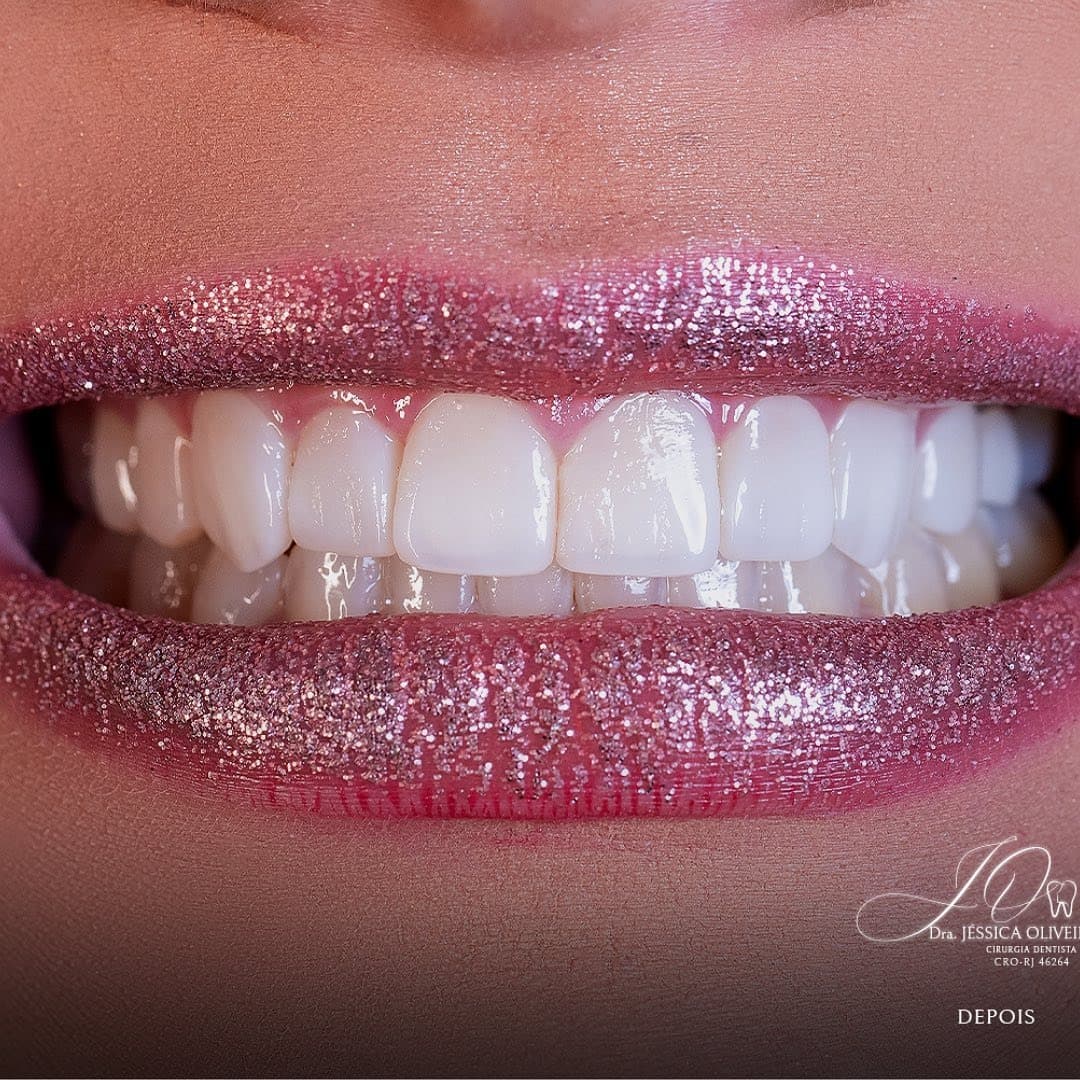 Transformação real — confiança que começa no sorriso