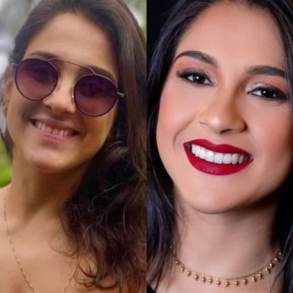 Resultado natural — ninguém percebe que é tratamento